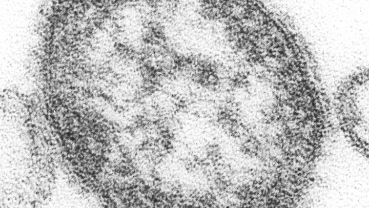 Original Title: 4424-measles-single particle